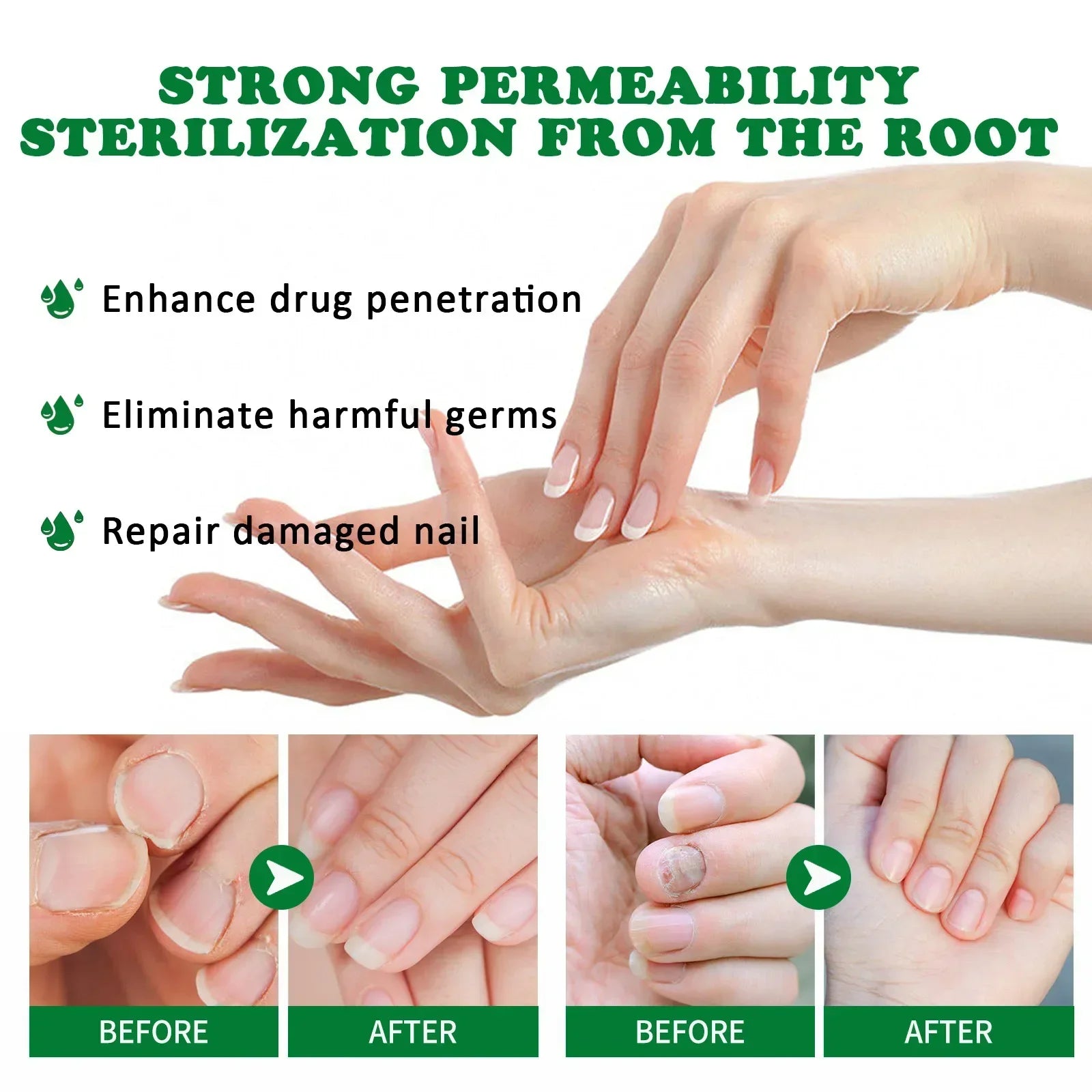 7 Days Nail Fungal Treatment Essence Fungus Removal Serum Repair All Natural Formula