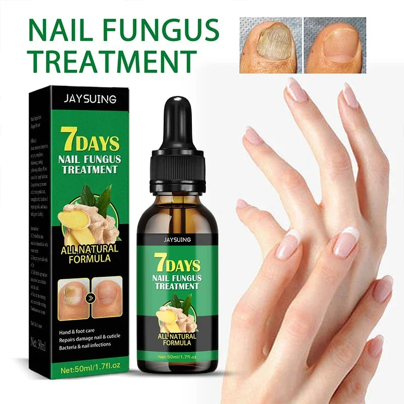 7 Days Nail Fungal Treatment Essence Fungus Removal Serum Repair All Natural Formula