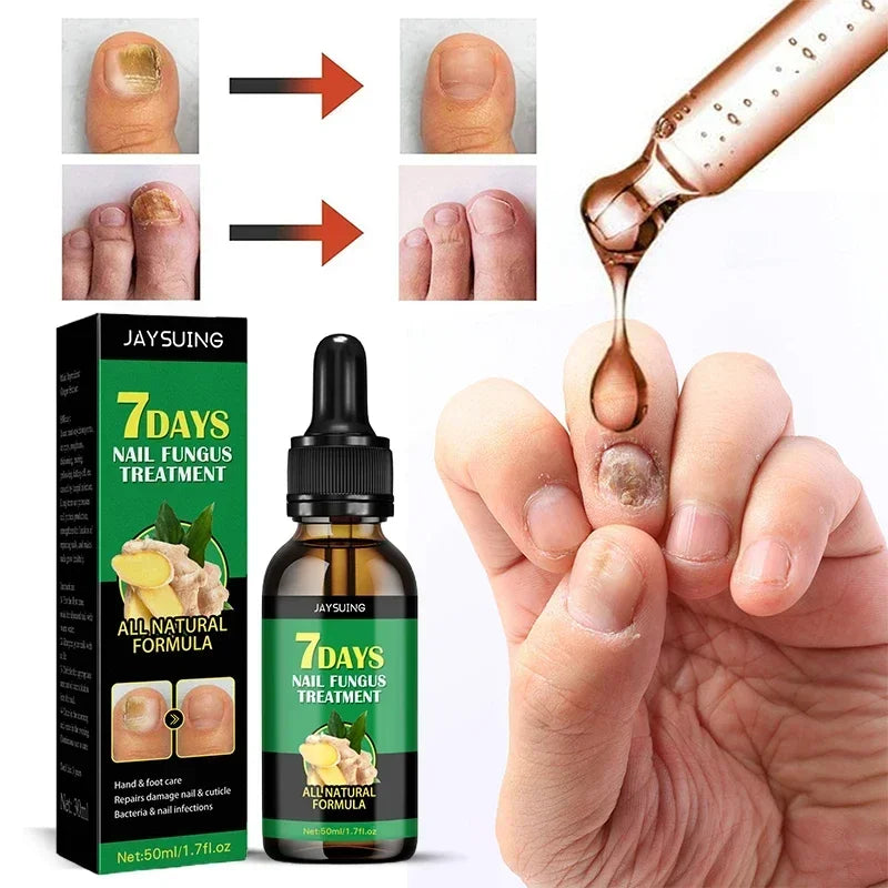 7 Days Nail Fungal Treatment Essence Fungus Removal Serum Repair All Natural Formula